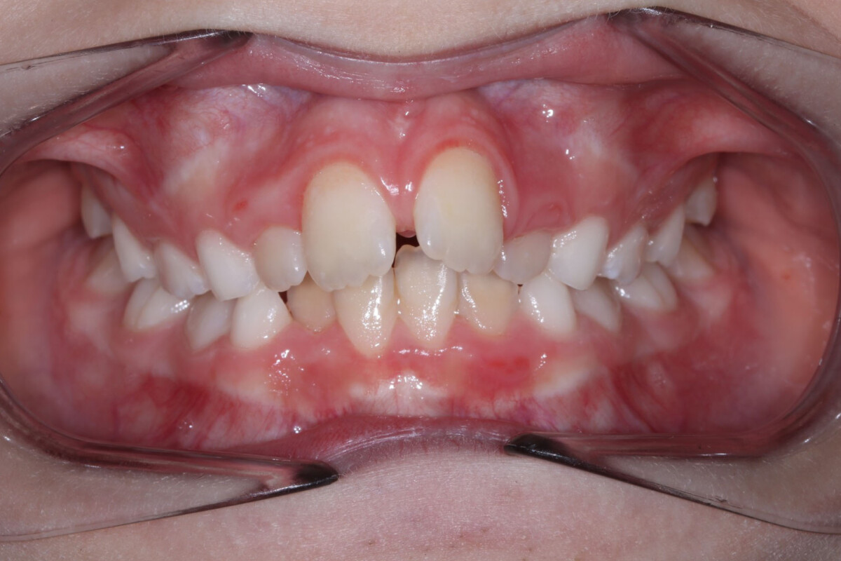 Before image