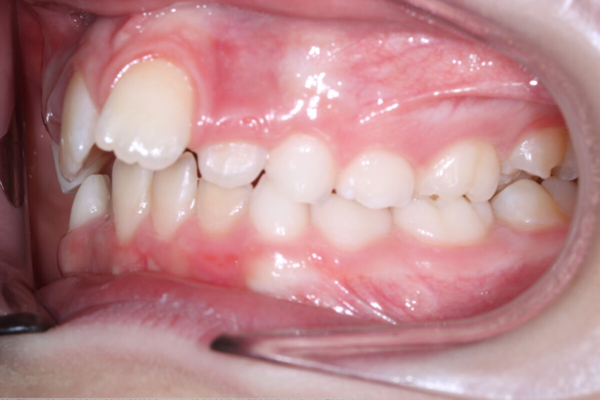 Before image