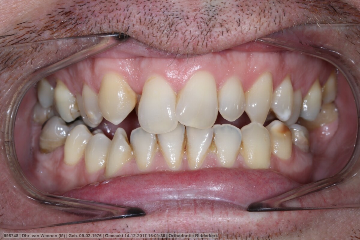 Before image