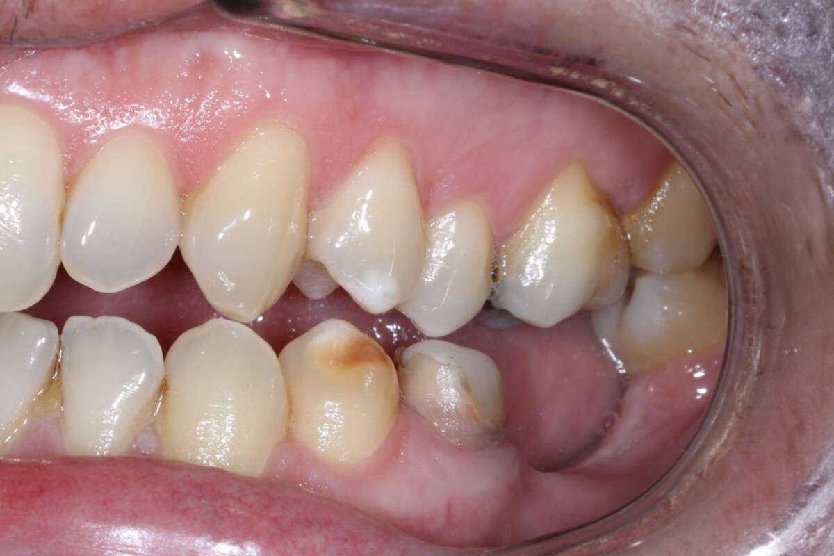Before image