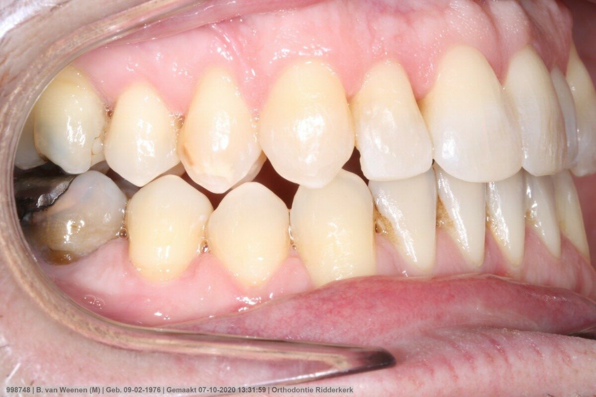 After image