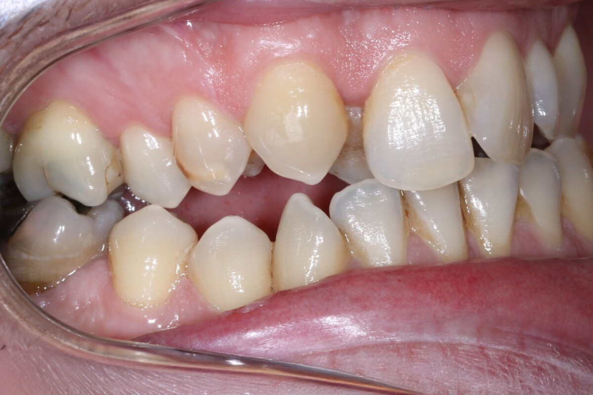 Before image
