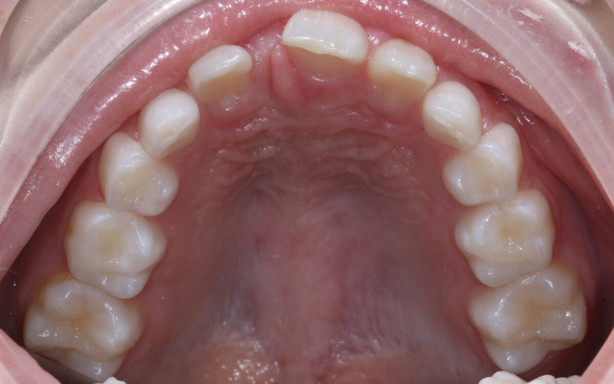 Before image
