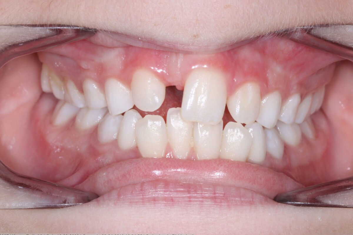 Before image