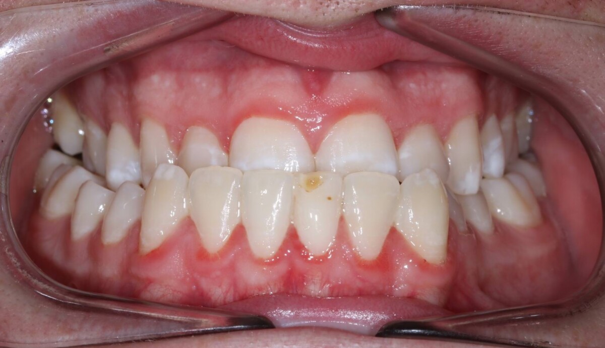 Before image