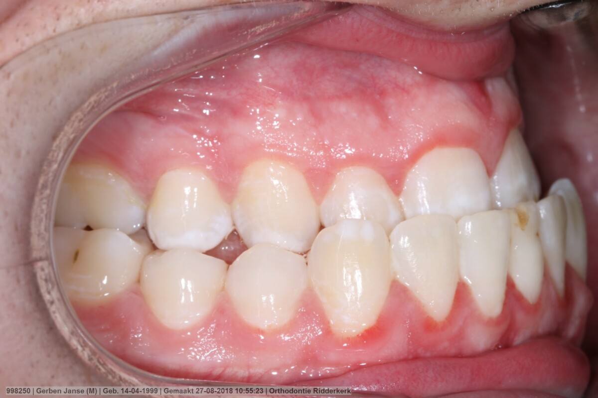Before image