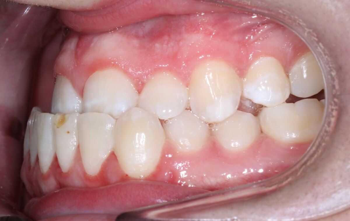 Before image