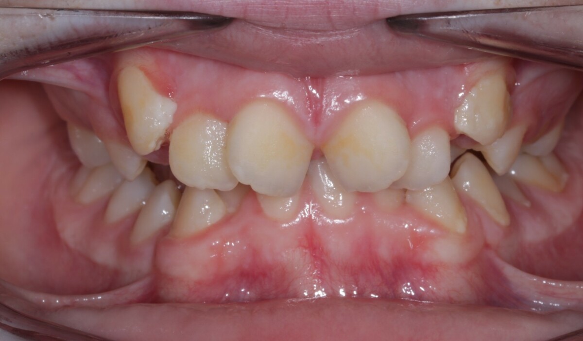 Before image