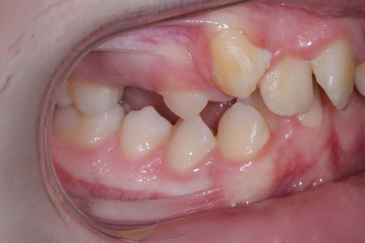Before image
