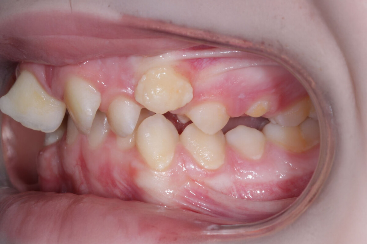 Before image