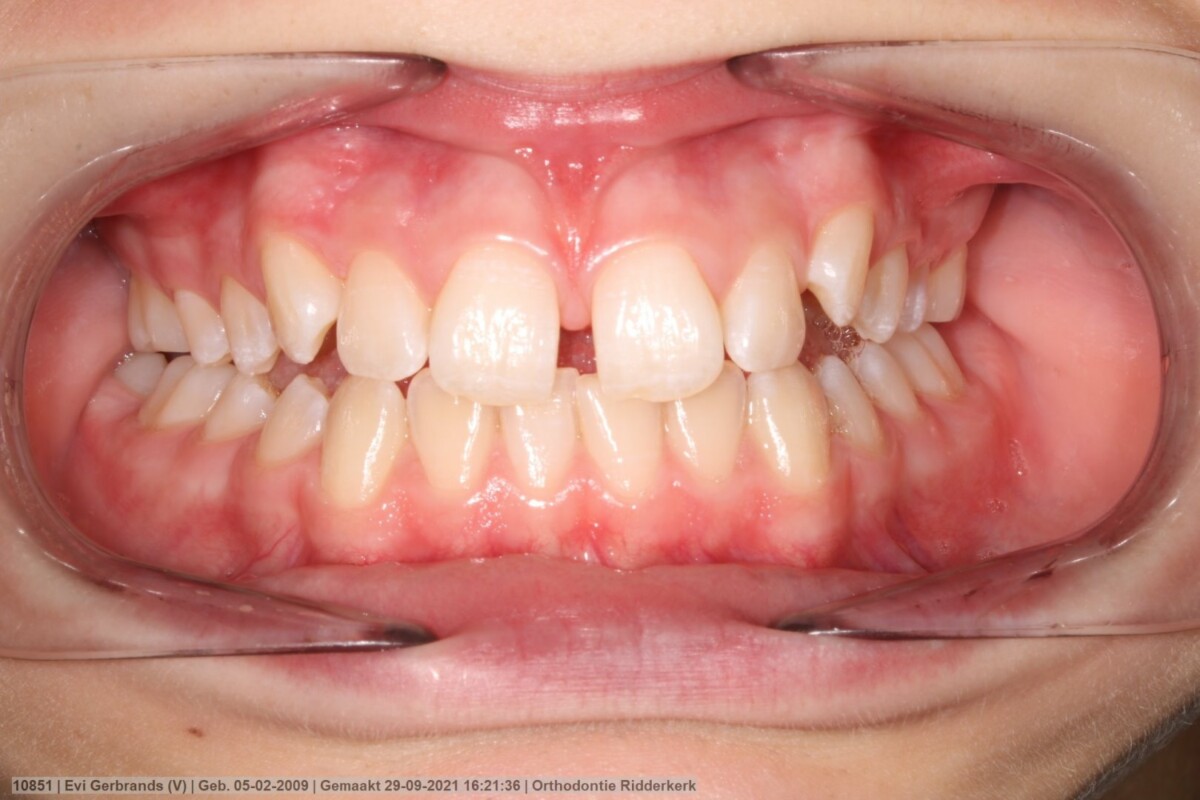 Before image