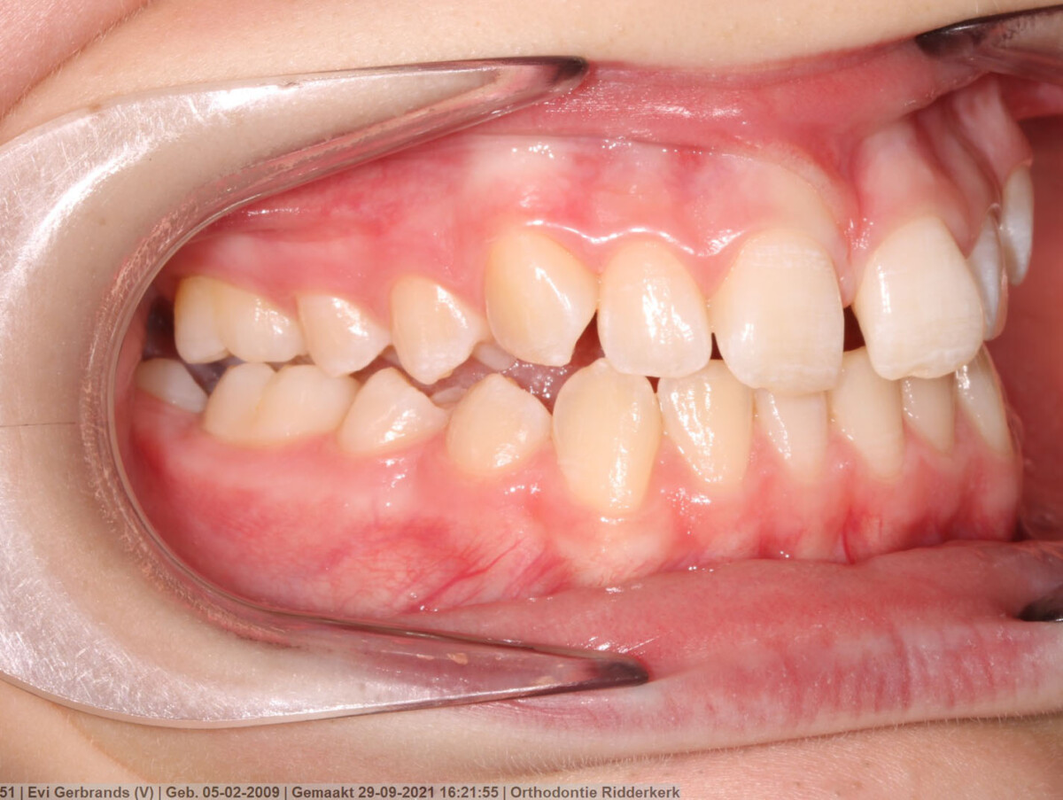 Before image