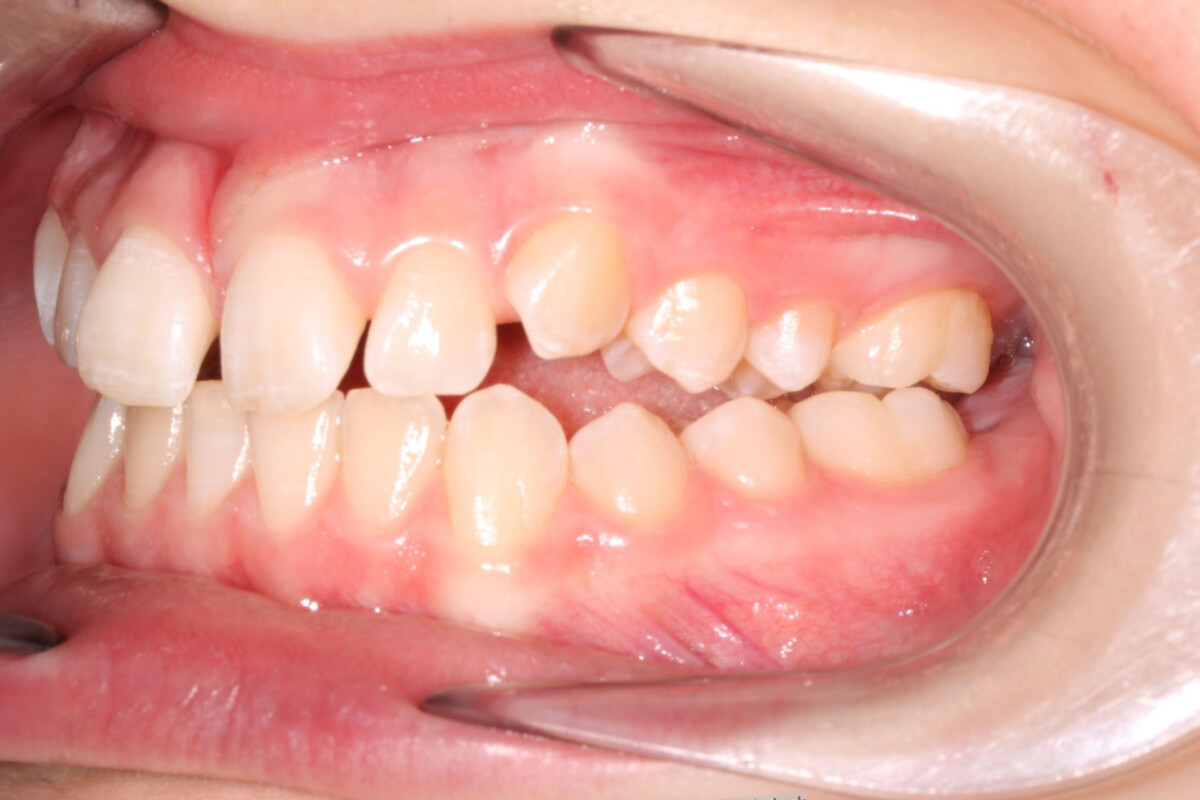 Before image