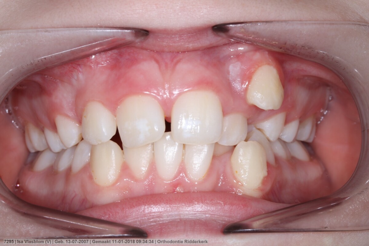 Before image