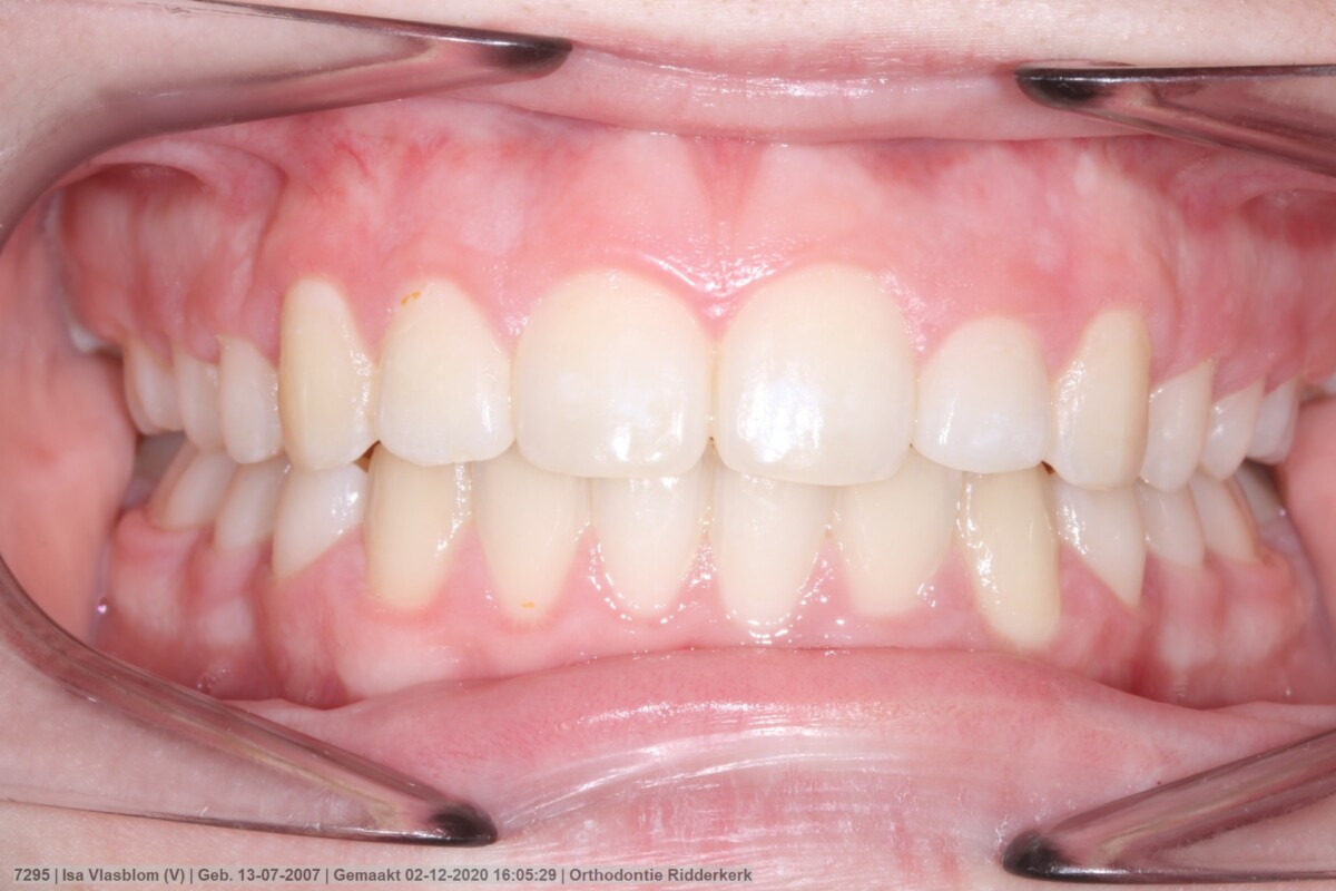 After image