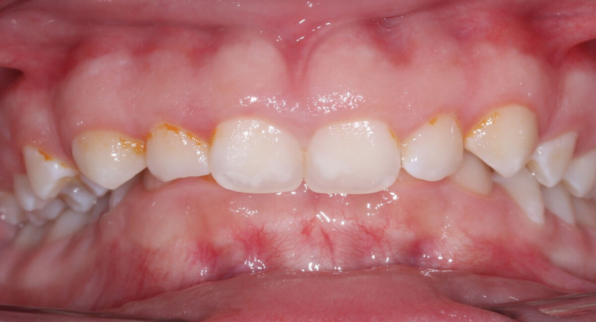 Before image