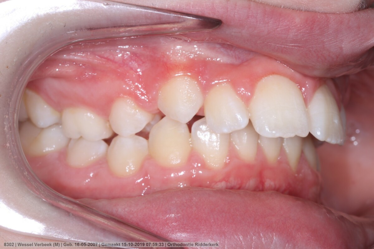 Before image