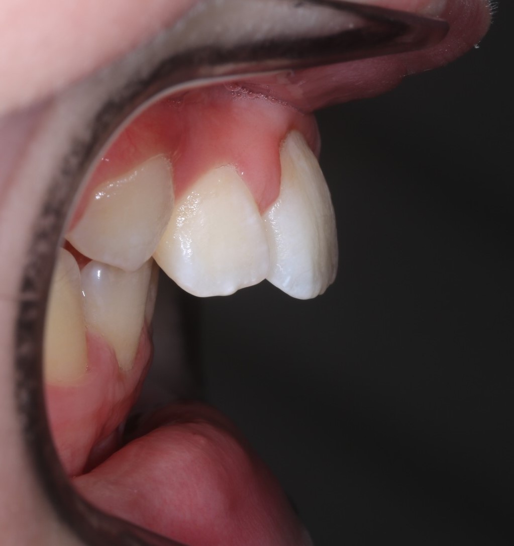 Before image