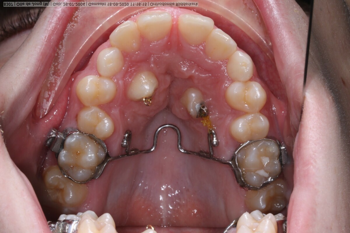 Before image