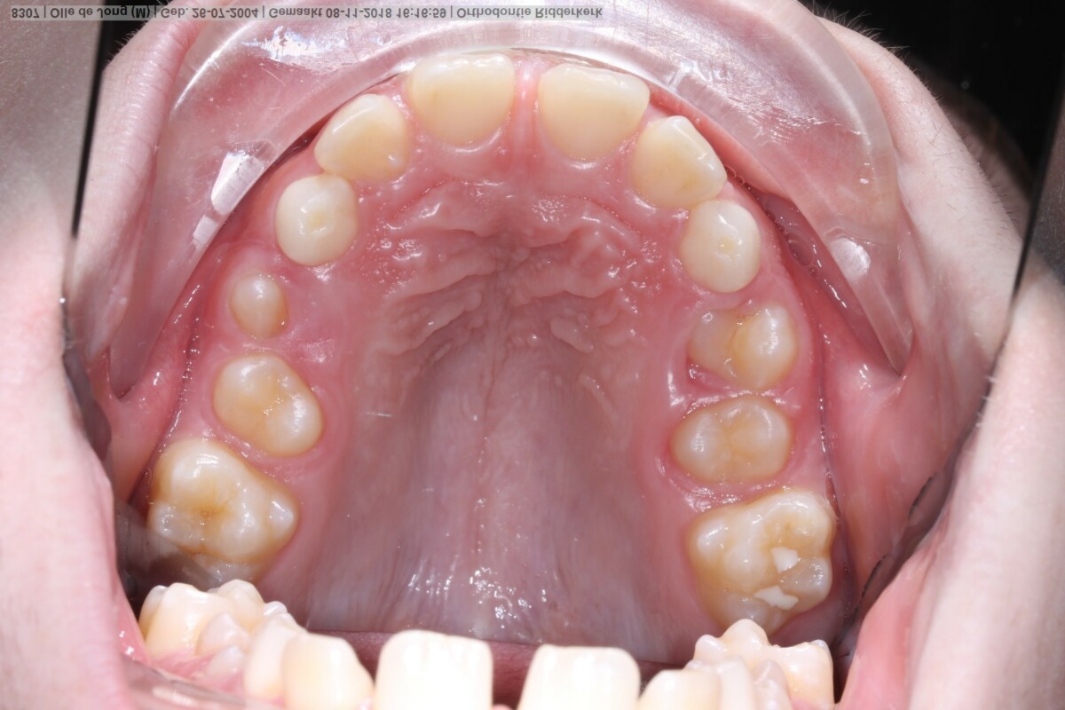 After image