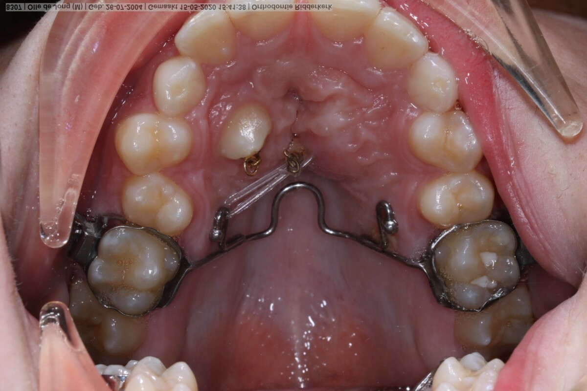 Before image