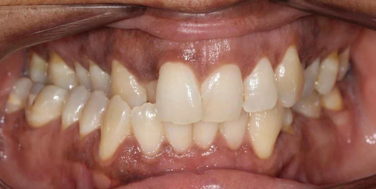 Before image