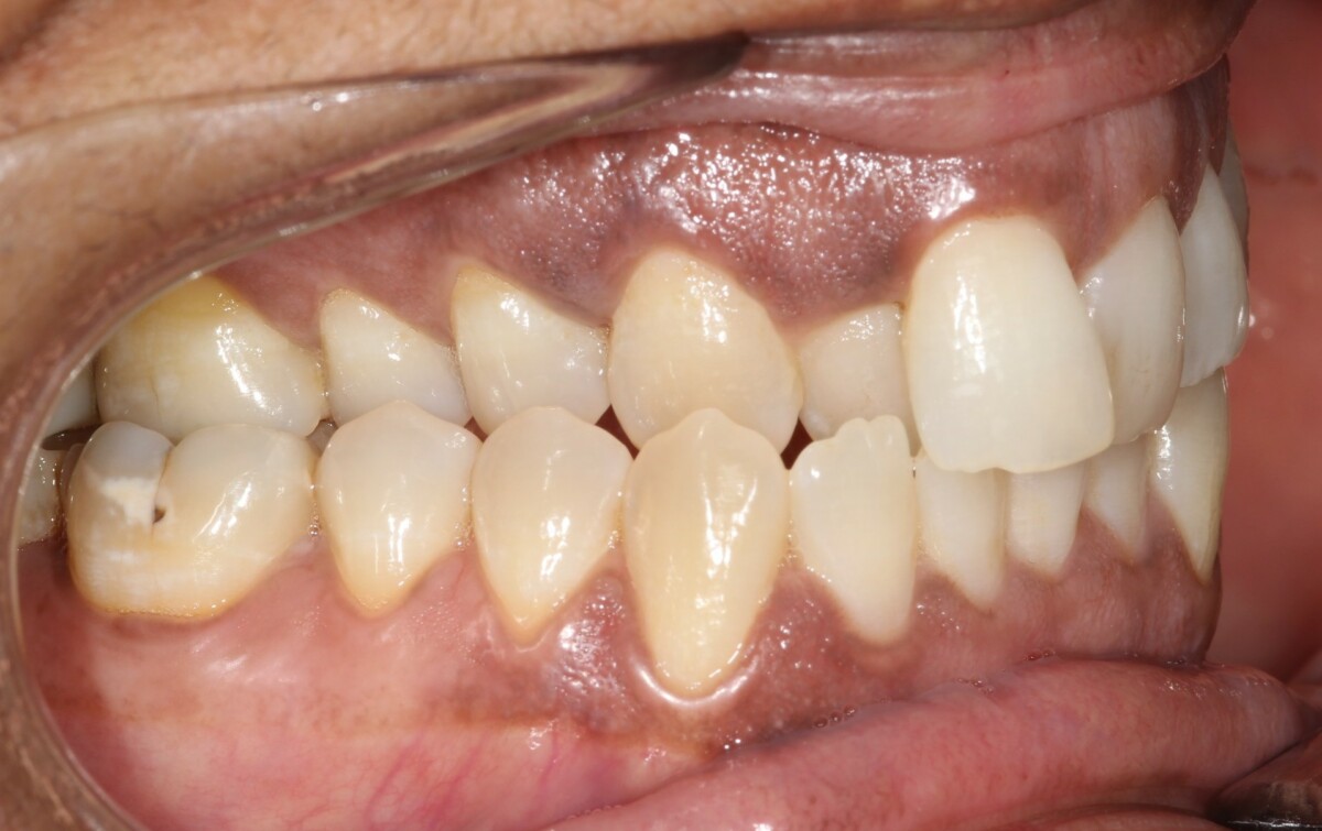 Before image