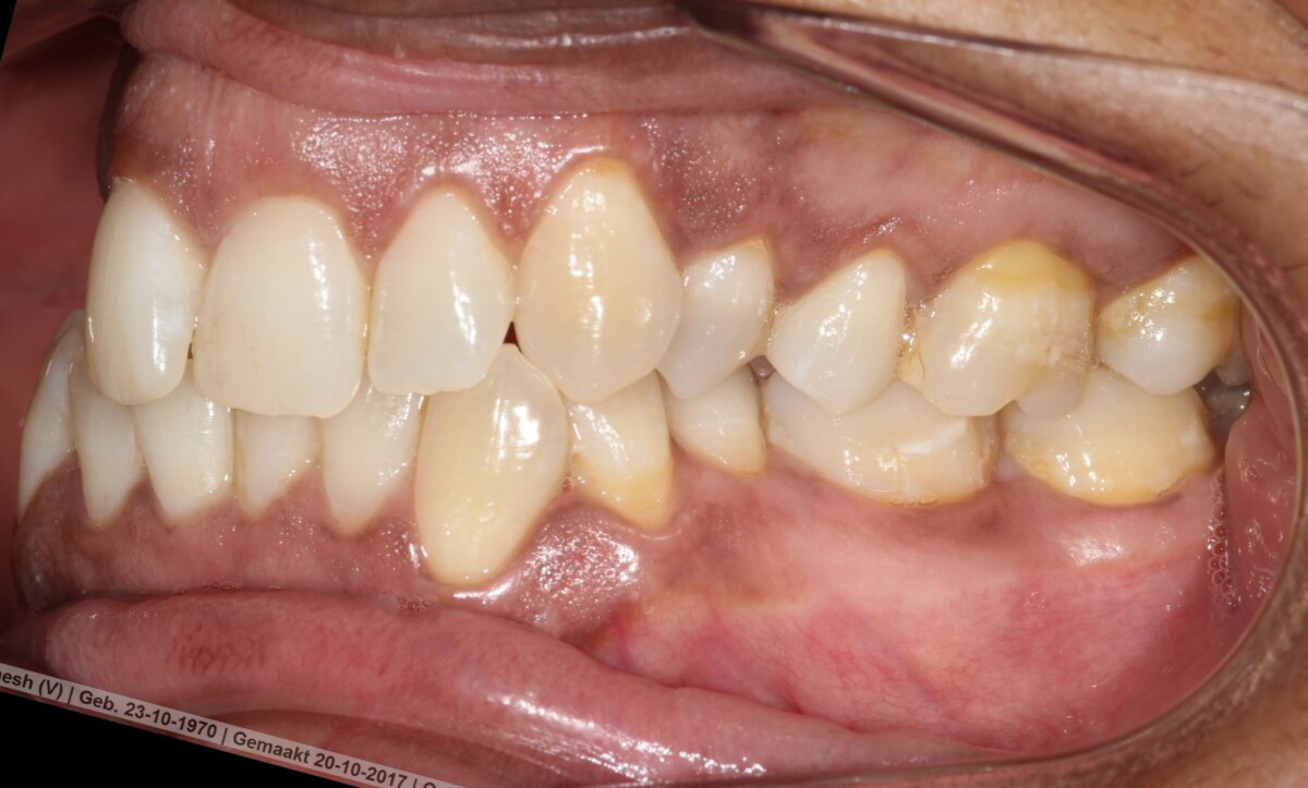 Before image