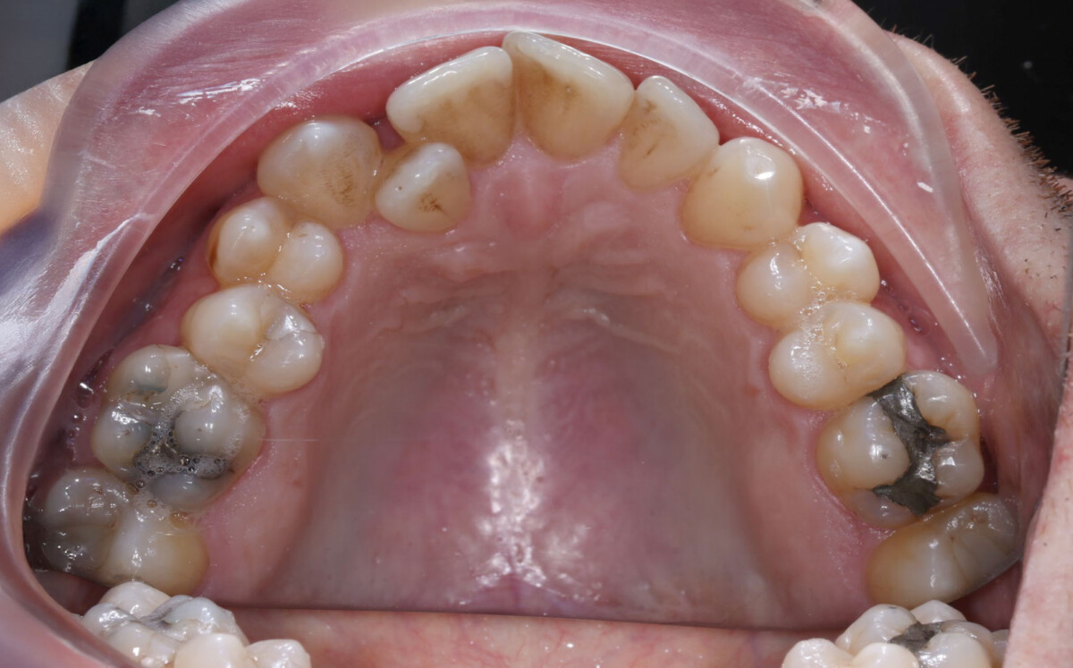 Before image
